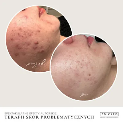 EDICARE Estetyka - Gabinet Kosmetologiczny